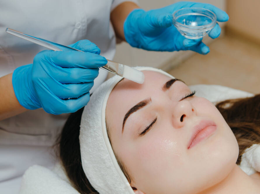 Peeling Químico - Bilacare