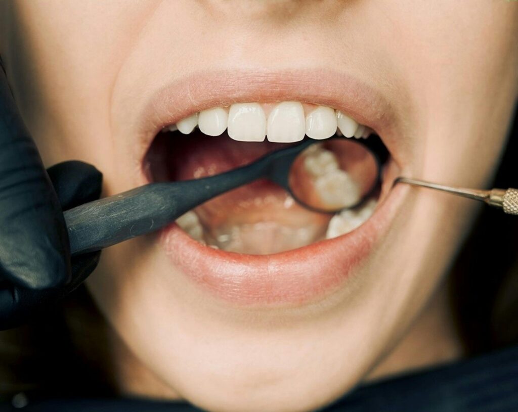 Higiene oral